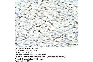 Rabbit Anti-HNRPA3 Antibody  Paraffin Embedded Tissue: Human Heart Cellular Data: Myocardial cells Antibody Concentration: 4.