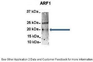 Amount and Sample Type :  500 ug rat brain homogenate  Amount of IP Antibody :  6 ug  Primary Antibody :  ARF1  Primary Antibody Dilution :  1:500  Secondary Antibody :  Goat anti-rabbit Alexa-Fluor 594  Secondary Antibody Dilution :  1:5000  Gene Name :  ARF1  Submitted by :  Dr. (ARF1 anticorps  (Middle Region))