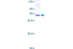 Annexin A5 (ANXA5) (AA 1-320) protein (GST tag)