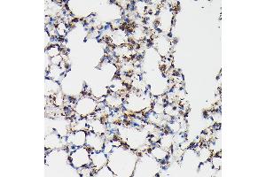 Immunohistochemistry of paraffin-embedded mouse lung using SFTP Rabbit pAb (ABIN3017436, ABIN3017437, ABIN3017438 and ABIN6220091) at dilution of 1:50 (40x lens).