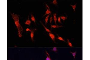 Immunofluorescence analysis of PC12 cells using EGFR Polyclonal Antibody at dilution of 1:100.