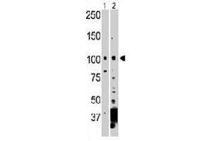 The NEK9 polyclonal antibody  is used in Western blot to detect NEK9 in 293 cell lysate (Lane 1) and mouse heart tissue lysate (Lane 2) . (NEK9 anticorps  (C-Term))