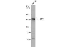 WB Image ENPP1 antibody detects ENPP1 protein by western blot analysis. (ENPP1 anticorps)