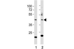 Western blot testing of E2F1 antibody at 1:1000 dilution. (E2F1 anticorps  (AA 342-371))