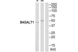 Western blot analysis of extracts from Jurkat/293 cells, using B4GALT1 antibody.