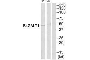 Western blot analysis of extracts from Jurkat/293 cells, using B4GALT1 antibody. (B4GALT1 anticorps  (C-Term))