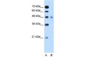 SLC17A4 antibody used at 1 ug/ml to detect target protein. (SLC17A4 anticorps)