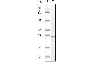 Western Blotting (WB) image for anti-S100 Calcium Binding Protein A1 (S100A1) (truncated) antibody (ABIN2464101)