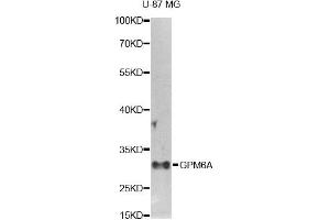 Western blot analysis of extracts of U-87MG cells, using GPM6A antibody. (GPM6A anticorps)
