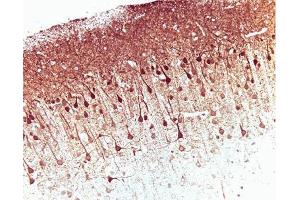Immunohistochemical staining on a rat brain formalin-fixed, paraffin-embedded section with citrate buffer pretreatment.