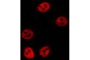 ABIN6277140 staining  HuvEc cells by IF/ICC. (ALOX5 anticorps  (C-Term))