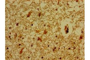 Immunohistochemistry of paraffin-embedded human brain tissue using ABIN7159217 at dilution of 1:100 (MC5 Receptor anticorps  (AA 1-37))