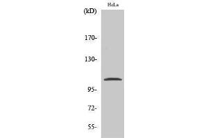 Western Blotting (WB) image for anti-Nuclear Factor of kappa Light Polypeptide Gene Enhancer in B-Cells 1 (NFKB1) (pSer932) antibody (ABIN3182084)