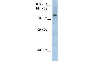 WB Suggested Anti-PRPF6 Antibody Titration:  2. (PRP6/ANT-1 anticorps  (N-Term))