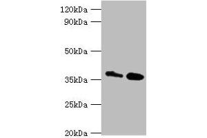 Western blot All lanes: CTSK antibody at 8 μg/mL Lane 1: MCF-7 whole cell lysate Lane 2: Rat brain tissue Secondary Goat polyclonal to rabbit IgG at 1/10000 dilution Predicted band size: 37 kDa Observed band size: 37 kDa (Cathepsin K anticorps  (AA 115-329))