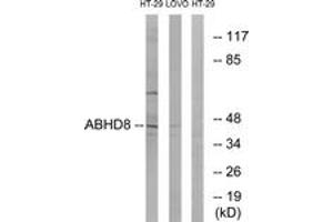 Western blot analysis of extracts from HT-29/LOVO cells, using ABHD8 Antibody.