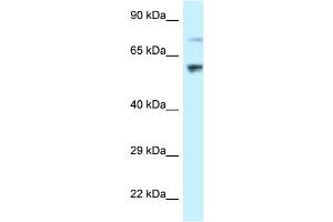 WB Suggested Anti-RSL1D1 Antibody Titration: 1. (RSL1D1 anticorps  (C-Term))