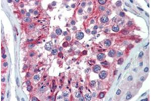 Human Testis (formalin-fixed, paraffin-embedded) stained with LIN28 antibody ABIN462196 followed by biotinylated goat anti-rabbit IgG secondary antibody ABIN481713, alkaline phosphatase-streptavidin and chromogen.