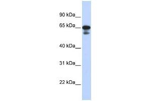 WB Suggested Anti-MIZF Antibody Titration:  0. (HINFP anticorps  (Middle Region))