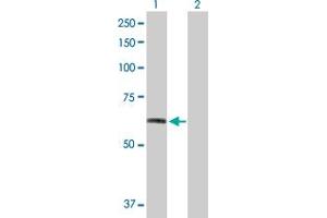 Lane 1: FGFR1 transfected lysate ( 81. (FGFR1 293T Cell Transient Overexpression Lysate(Denatured))