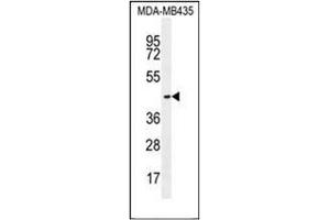 Western blot analysis of OR2L13 Antibody (C-term) in MDA-MB435 cell line lysates (35ug/lane). (OR2L13 anticorps  (C-Term))