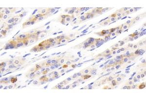 Detection of SCGN in Mouse Stomach Tissue using Polyclonal Antibody to Secretagogin (SCGN) (SCGN anticorps  (AA 1-276))