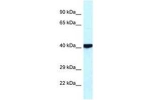 Image no. 1 for anti-Protein Kinase, CAMP Dependent, Catalytic, beta (PRKACB) (C-Term) antibody (ABIN6744075)