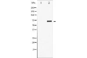 Western blot analysis of LIMK1 phosphorylation expression in COLO205 whole cell lysates,The lane on the left is treated with the antigen-specific peptide.