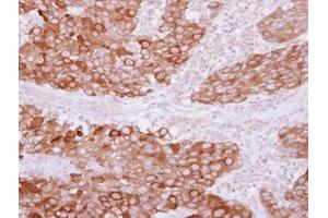 Image no. 1 for anti-Phosphotidylinositol Transfer Protein, beta (PITPNB) (AA 1-266) antibody (ABIN1500227)