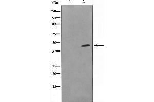 Western blot analysis on COLO205 cell lysate using DOK6 Antibody，The lane on the left is treated with the antigen-specific peptide. (DOK6 anticorps  (Internal Region))