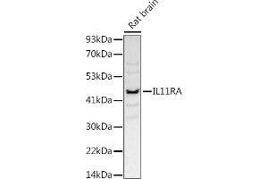 Western blot analysis of extracts of Rat brain, using (ABIN7267984) at 1:1000 dilution. (IL11RA anticorps)