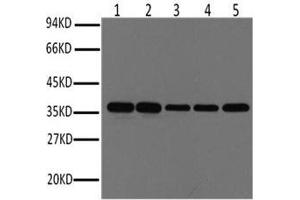Western Blot analysis of Hela, Rat brain, Rabbit muscle, Sheep muscle, Mouse brain using GAPDH Monoclonal Antibody at dilution of 1:1000. (GAPDH anticorps)