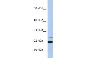 WB Suggested Anti-IL4 Antibody Titration: 0. (IL-4 anticorps  (Middle Region))
