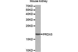 Western Blotting (WB) image for anti-Peroxiredoxin 5 (PRDX5) (AA 53-214) antibody (ABIN1682285) (Peroxiredoxin 5 anticorps  (AA 53-214))