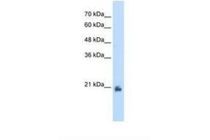 Image no. 1 for anti-Methyltransferase Like 7A (METTL7A) (AA 51-100) antibody (ABIN320717) (METTL7A anticorps  (AA 51-100))