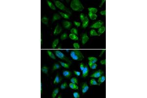 Immunofluorescence analysis of HepG2 cell using KIR2DL3 antibody. (KIR2DL3 anticorps  (AA 22-245))