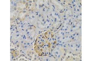 Immunohistochemistry of paraffin-embedded Rat kidney using FLT3 Polyclonal Antibody