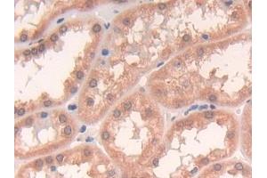 Detection of CPR in Human Kidney Tissue using Polyclonal Antibody to Cytochrome P450 Reductase (CPR)