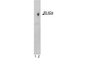 Western blot analysis of NF-kappaB p65 (pS529) in human peripheral blood mononuclear cells (PBMC). (NFkB anticorps  (pSer529))