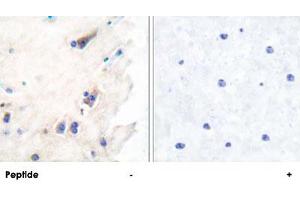 Immunohistochemical analysis of paraffin-embedded human brain tissue using PLCB3 polyclonal antibody . (PLCB3 anticorps  (Ser1105))
