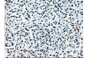 Immunohistochemical staining of paraffin-embedded colon tissue using anti-MAP2K4mouse monoclonal antibody. (MAP2K4 anticorps)