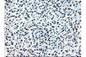 Immunohistochemical staining of paraffin-embedded colon tissue using anti-MAP2K4mouse monoclonal antibody.