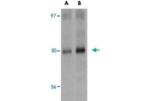 Western blot analysis of SQSTM1 in human spleen tissue lysate with SQSTM1 polyclonal antibody  at (A) 1 and (B) 2 ug/mL . (SQSTM1 anticorps  (C-Term))