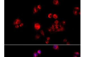 Immunofluorescence analysis of HeLa cells using GLUD2 Polyclonal Antibody at dilution of 1:100 (40x lens). (GLUD2 anticorps)