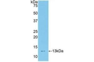 Detection of Recombinant TCF20, Mouse using Polyclonal Antibody to Transcription factor 20 (TCF20)