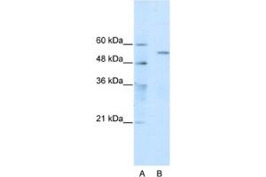 Western Blotting (WB) image for anti-Tripartite Motif Containing 35 (TRIM35) antibody (ABIN2461068) (TRIM35 anticorps)