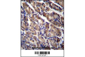 ABRA Antibody immunohistochemistry analysis in formalin fixed and paraffin embedded human stomach tissue followed by peroxidase conjugation of the secondary antibody and DAB staining. (ABRA anticorps  (C-Term))