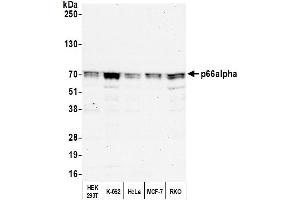 Western Blotting (WB) image for anti-GATA Zinc Finger Domain Containing 2A (GATAD2A) (AA 573-633) antibody (ABIN7454824)
