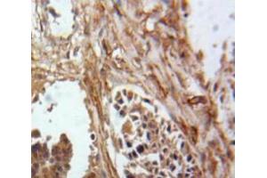 IHC-P analysis of Ovary tissue, with DAB staining. (Inhibin alpha anticorps  (AA 25-363))