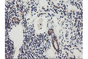 Image no. 1 for anti-RNA Binding Protein with Multiple Splicing (RBPMS) antibody (ABIN1500647)